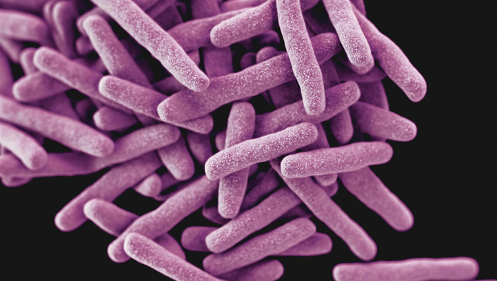 RISCHIO BIOLOGICO DA MYCOBACTERIUM TUBERCOLOSIS